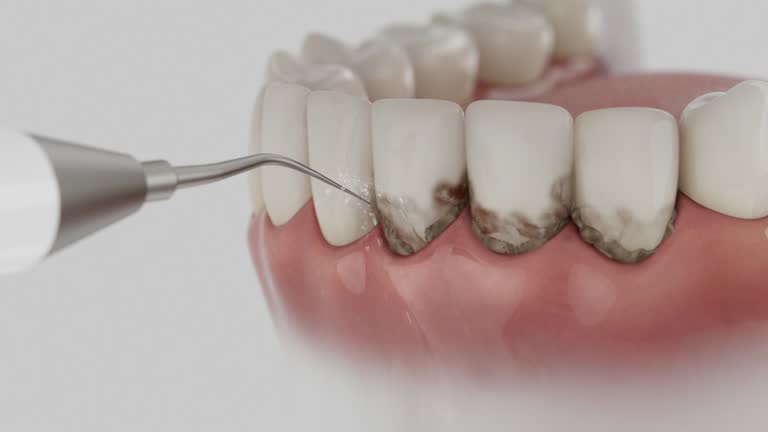 Trusted Wisdom Tooth Removal service in Bright, IN - Dentist Open Now
